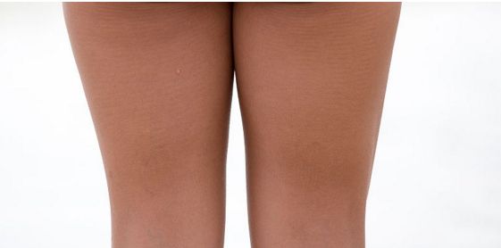 杭州治疤痕那個醫(yī)院好？解析杭州治疤痕醫(yī)院榜單