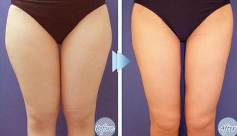 如何選擇最適合您的除腋臭治療醫(yī)院？全國哪家醫(yī)院好？