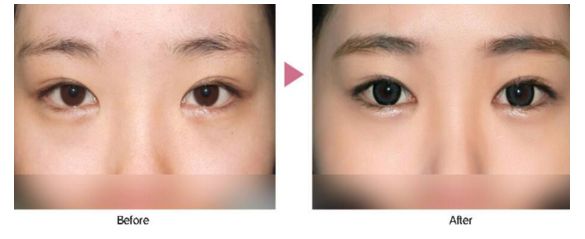 珠海整形醫(yī)院去哪家好？挑選術(shù)前評(píng)價(jià)好的整形醫(yī)院，放心修復(fù)您的美麗