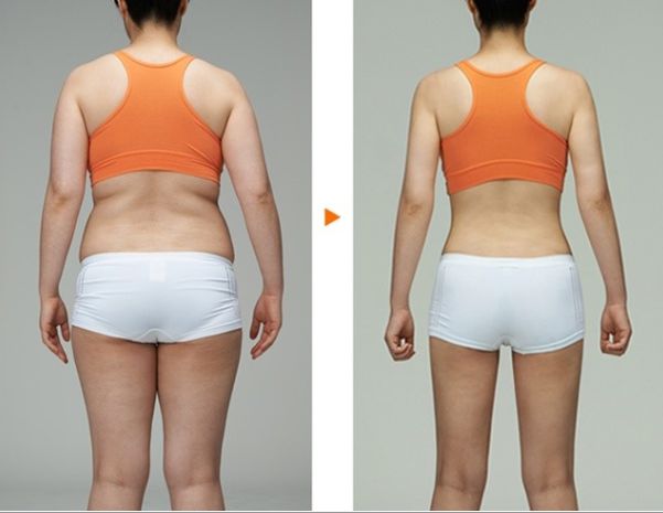 南京吸脂瘦臉哪家醫(yī)院好？全面解析南京吸脂手術(shù)的醫(yī)院排名及選擇攻略