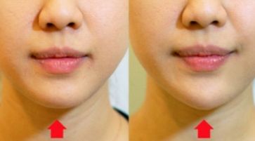 南京整容手術(shù)最靠譜的醫(yī)院排行榜，告訴你南京做整容手術(shù)醫(yī)院哪家好