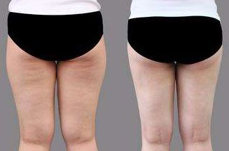 菏澤市整形醫(yī)院哪家好？排名榜單發(fā)布