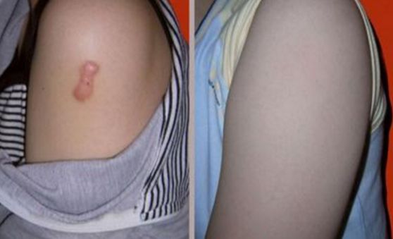 上海雙眼皮切開手術(shù)，哪家醫(yī)院技術(shù)好且安全？