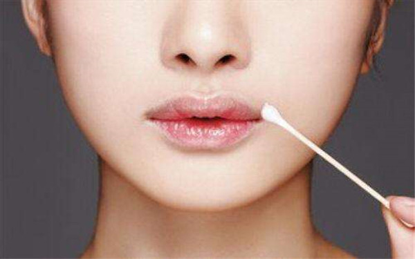 2023廣州除皺針去木偶紋正規(guī)醫(yī)生評分TOP10(楊權(quán)明、柳霞、丁莉美知名度很高)