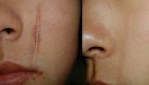 烏魯木齊眼袋手術(shù)專家推薦，哪家醫(yī)院好？