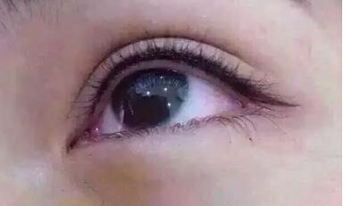 八大處整容醫(yī)院閆言皮膚性病治療的療效如何評(píng)價(jià)？