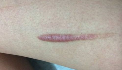 湘潭市美容哪家醫(yī)院好？探尋專家推薦，找到適合你的醫(yī)美機構！