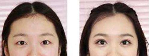 長沙整形科醫(yī)院排名及綜合評價(jià)：長沙哪家整形醫(yī)院口碑好？