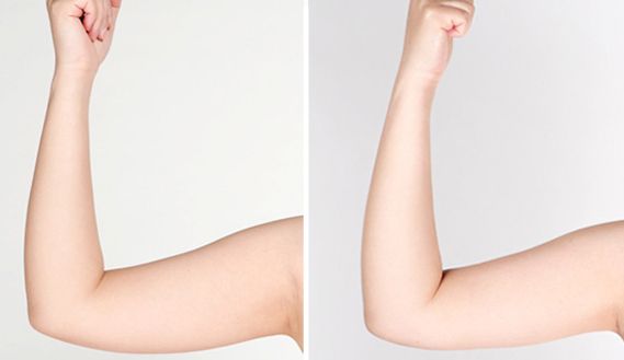 貴陽有哪些專業(yè)治療痘印痘坑的醫(yī)院值得推薦？