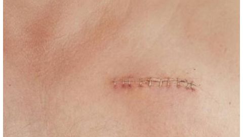 江蘇省中醫(yī)院整形科是否有專業(yè)資質(zhì)？醫(yī)生擅長哪些項(xiàng)目？簡介了解一下！