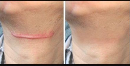 南京取出奧美定哪家好？南京市區(qū)有哪些口碑較好的奧美取出門店？