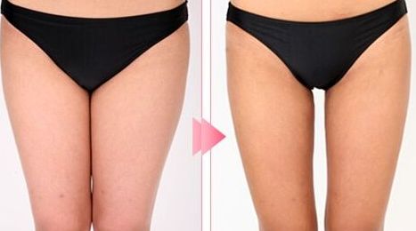 廊坊去斑的醫(yī)院哪家好？推薦您去哪家專業(yè)的醫(yī)院進(jìn)行去斑治療