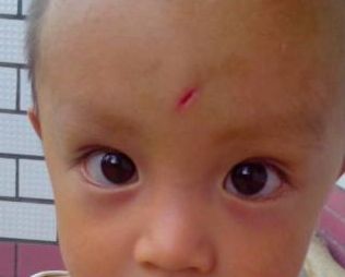 青島童顏線雕提升哪家好？選擇最佳青島童顏線雕醫(yī)院的3個(gè)關(guān)鍵因素