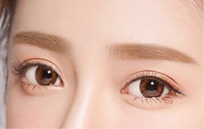 2023汕頭皮膚磨削治太田痣排名前幾的醫(yī)生(黎國(guó)權(quán)、蘇國(guó)藝、梁威杰網(wǎng)友認(rèn)可度高)