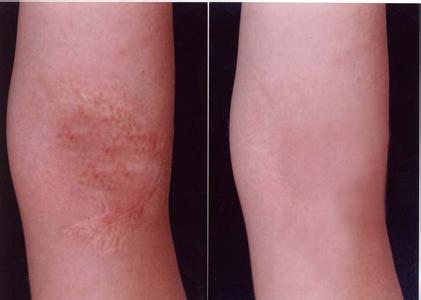 2023沈陽(yáng)面下2/3除皺口碑排行前10專(zhuān)家(莊綏、張晨、連園園看到就是賺到)