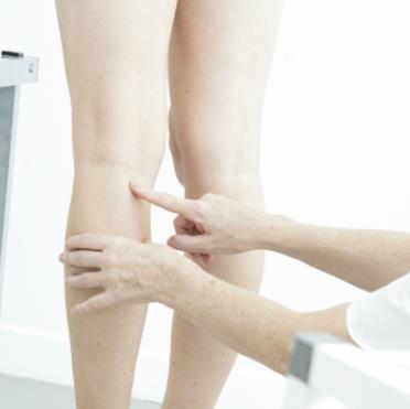 南方醫(yī)院的孫鳳陽(yáng)教授如何實(shí)施正畸矯正及收費(fèi)展示