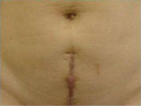 天津祛痘醫(yī)院哪家效果好？為您推薦天津?qū)I(yè)祛痘醫(yī)院排行榜