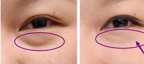 東莞豐胸醫(yī)生名單推薦！權(quán)威醫(yī)師梁如光、鄭志敏等值得信賴