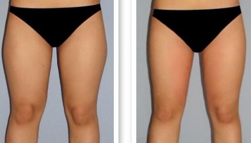 濟南祛痘哪家醫(yī)院技術(shù)好？選擇哪家醫(yī)院更靠譜？