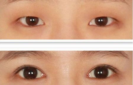 北京整容科好的醫(yī)院有哪些？中關村整形醫(yī)院綜合實力領先！