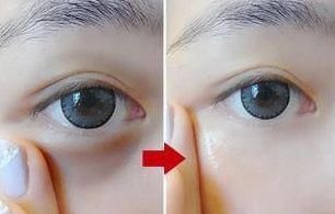 西安微整醫(yī)院排行榜2023：哪家最好？