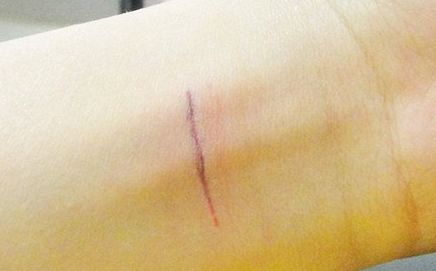 上海哪家隆鼻醫(yī)院好且正規(guī)？優(yōu)質(zhì)咨詢幫助你挑選合適的醫(yī)院