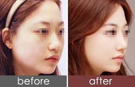 南京皮膚整形醫(yī)院排名及綜合評價，哪家好？