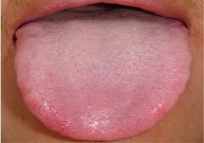 2023重慶微整形面部皺紋榜上前10名醫(yī)生(陳佳佳、徐軍、楊建看看哪一家更適合？)