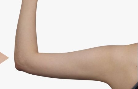 周柯做鼻子的效果及費用分析，醫(yī)生介紹與真實案例揭秘，打造自然又美觀的風(fēng)格