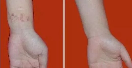 杭州哪家醫(yī)院看喉嚨好？排名最好的專業(yè)醫(yī)院推薦