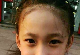 蘇州激光祛疤哪家醫(yī)院好？選擇激光祛疤專家，恢復(fù)美肌無憂！