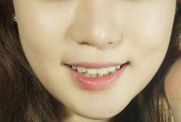 廣州集美醫(yī)療美容怎么樣？廣州集美醫(yī)療美容簡(jiǎn)介|醫(yī)生團(tuán)隊(duì)|口碑評(píng)價(jià)！