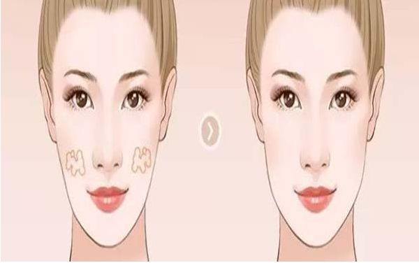 上海雙眼皮埋線醫(yī)院排名及專家推薦：哪家醫(yī)院最好？