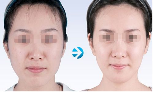 云南雙眼皮手術(shù)有哪些優(yōu)質(zhì)醫(yī)院值得推薦？