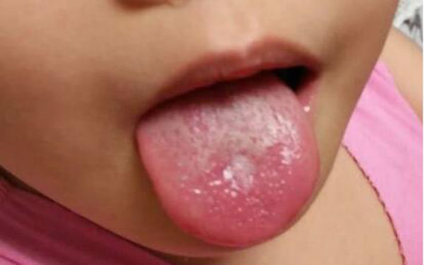 2023南昌祛除口周紋手術(shù)強(qiáng)榜前10的醫(yī)生(李焱麗、李丹、徐愛兵口碑技術(shù)并存)