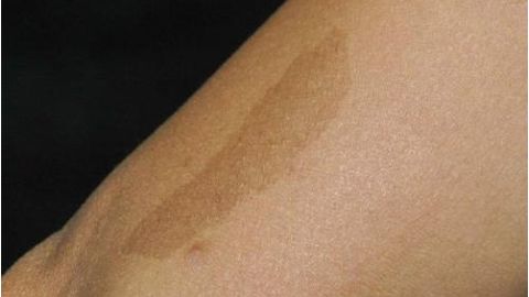 福仁醫(yī)療美容診所的醫(yī)生坐診介紹及技術(shù)點評，值得信賴嗎？