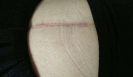 杭州市哪家醫(yī)院的玻尿酸注射技術(shù)更好？附醫(yī)生資料及整形科點評