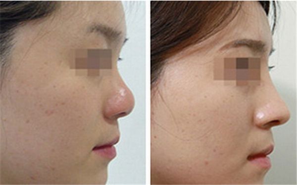 珠海市醫(yī)療美容醫(yī)院哪家好？解析當(dāng)今最受歡迎的珠海醫(yī)療美容機(jī)構(gòu)