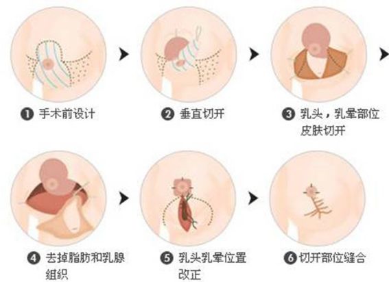 保定的整形醫(yī)院哪家好？全面解析保定整形醫(yī)院排名、口碑、專業(yè)團(tuán)隊(duì)等