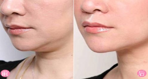 上海去除胎記醫(yī)院排名及口碑評測，哪家醫(yī)院最受用戶好評？