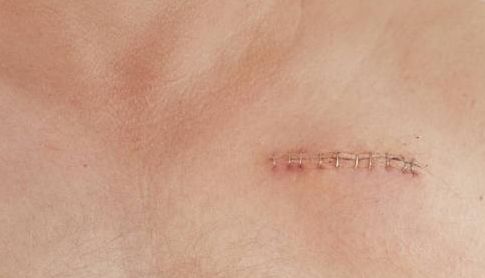 南昌市整形醫(yī)院哪家好？完全解析南昌市整形醫(yī)院的專業(yè)技術(shù)和服務(wù)