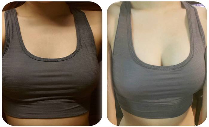 2023寧波嗨體祛黑眼圈正規(guī)醫(yī)生榜單前10強(qiáng)(許素玲、張娟娟、蔡慶水名列前茅~)