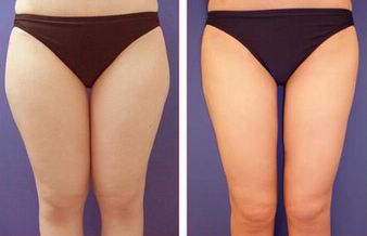 廣州看痘印哪家醫(yī)院好？細(xì)數(shù)廣州治療痘印最佳醫(yī)院！