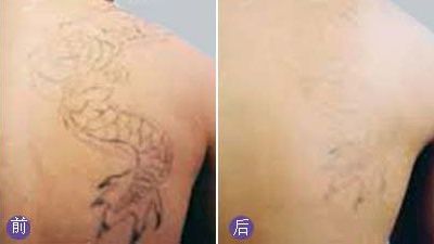 無錫哪家醫(yī)院眼科專業(yè)好？