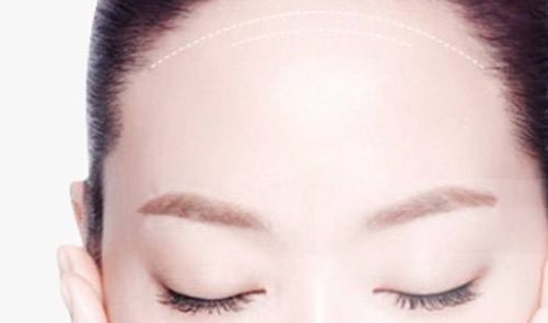 深圳哪家醫(yī)院的皮秒激光手術(shù)效果好？