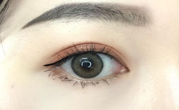 深圳眼部整形醫(yī)院哪家好？專家推薦最權(quán)威的深圳眼部整形醫(yī)院大全！