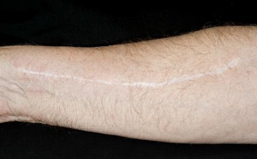 2023青島眼周紋手術(shù)去除醫(yī)生前十位強(qiáng)榜(蔡霞、吳延芳、劉肅資質(zhì)權(quán)威)