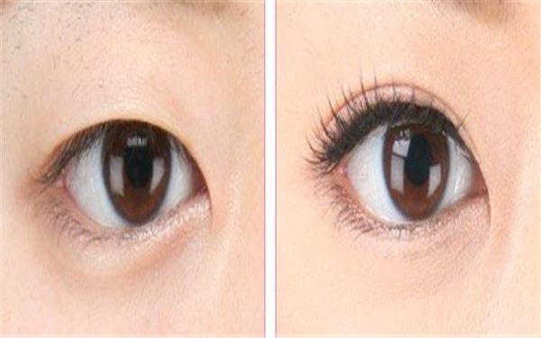 中國哪家醫(yī)院皮膚修復好？專家告訴你最靠譜的皮膚修復醫(yī)院有哪些