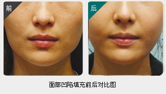 錦州整形美容醫(yī)院哪家靠譜？醫(yī)療技術(shù)如何？