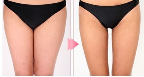 昆明哪家醫(yī)院做拉皮手術(shù)好？體驗(yàn)分享+專家推薦，盡在本文！